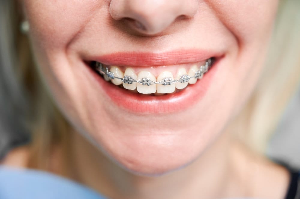 Orthodontist checking a patient's braces at Angel Smiles